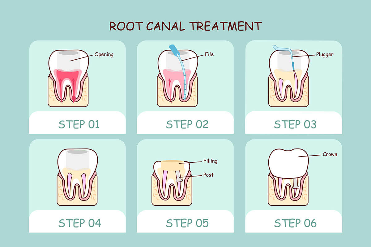 Potranco Road TX Dental Office