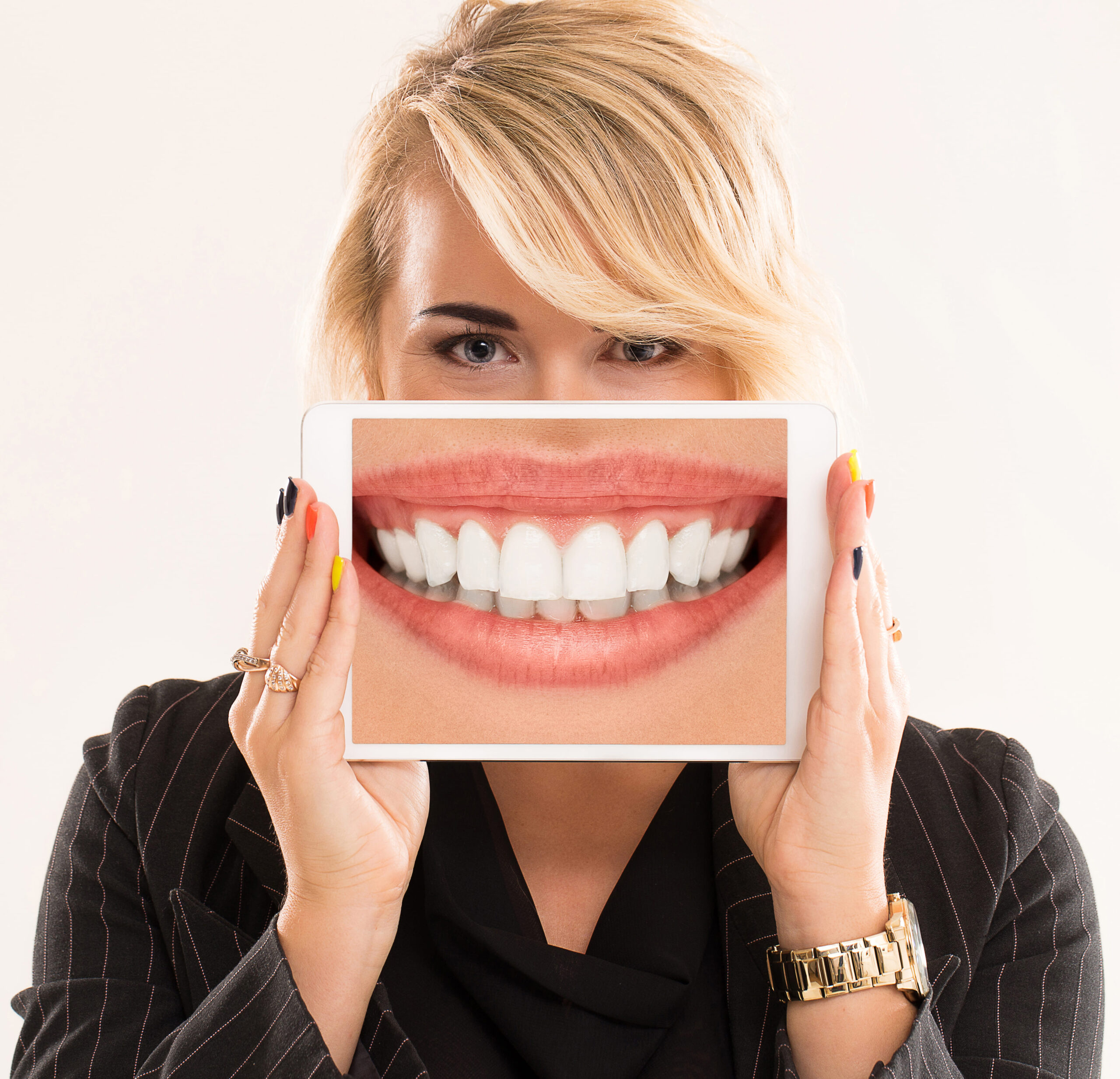 4 Most Common Questions About Teeth Whitening