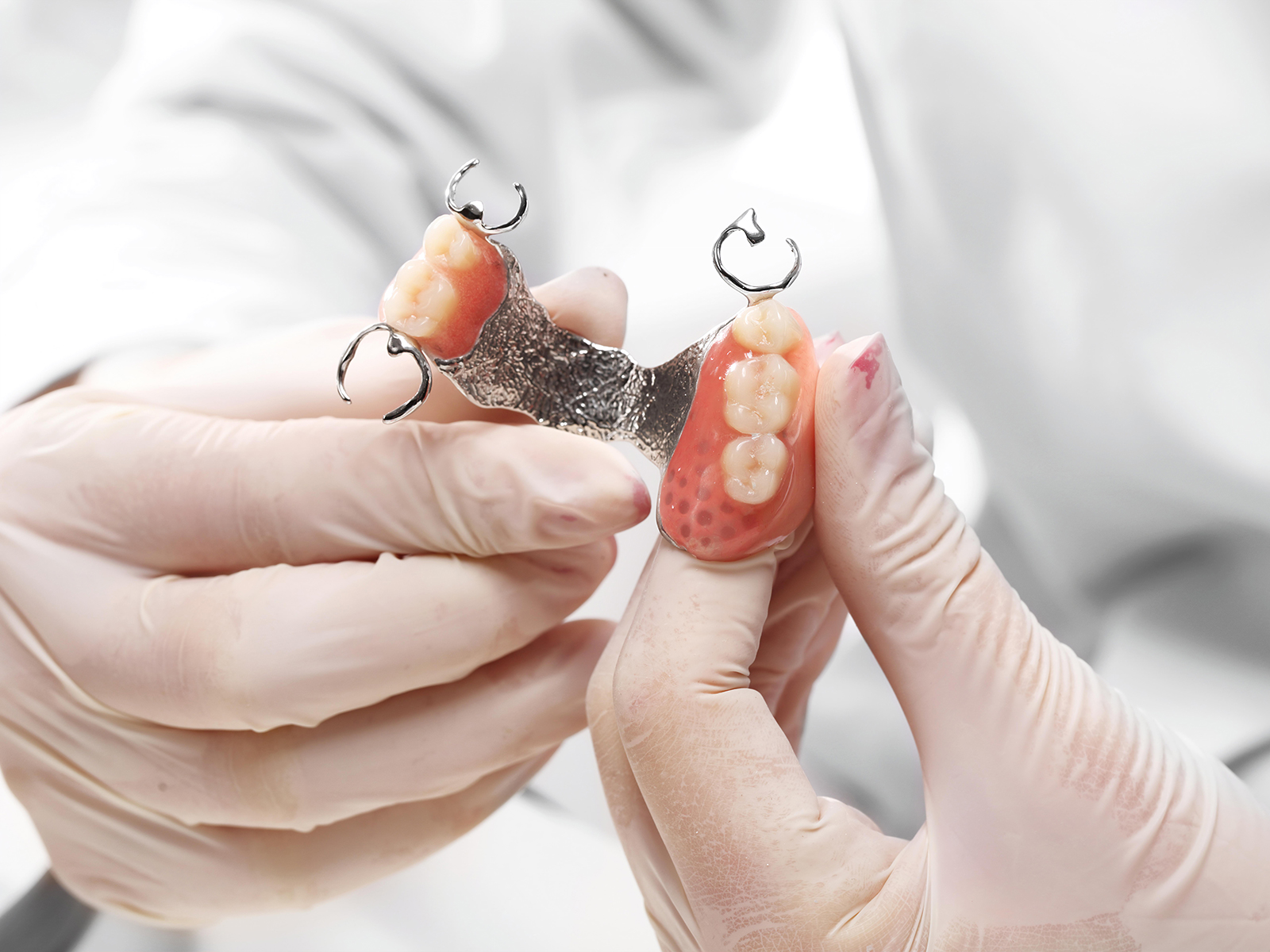 Common Concerns and Solutions for Partial Denture Wearers