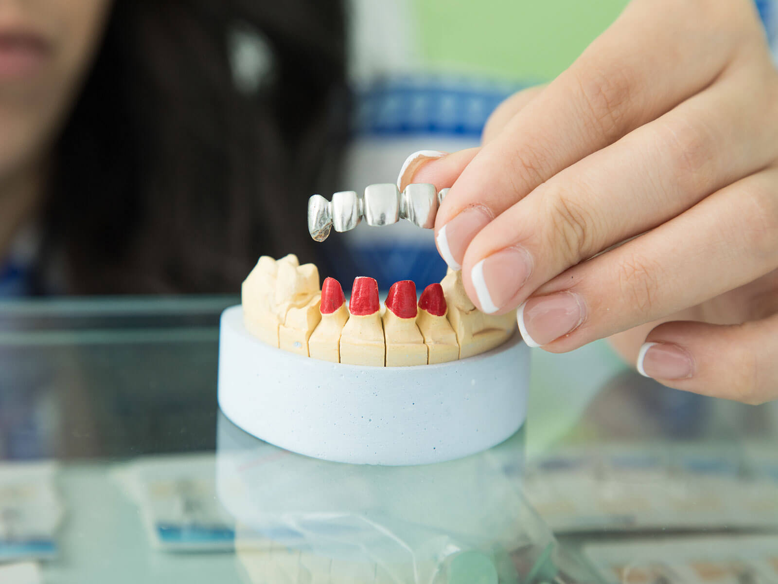 The Advantages of Porcelain Bridges For Missing Teeth
