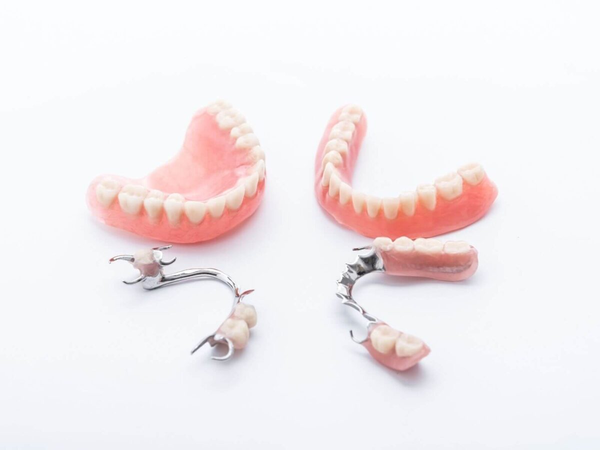 Emergency Denture Repair: What To Do When Dentures Break
