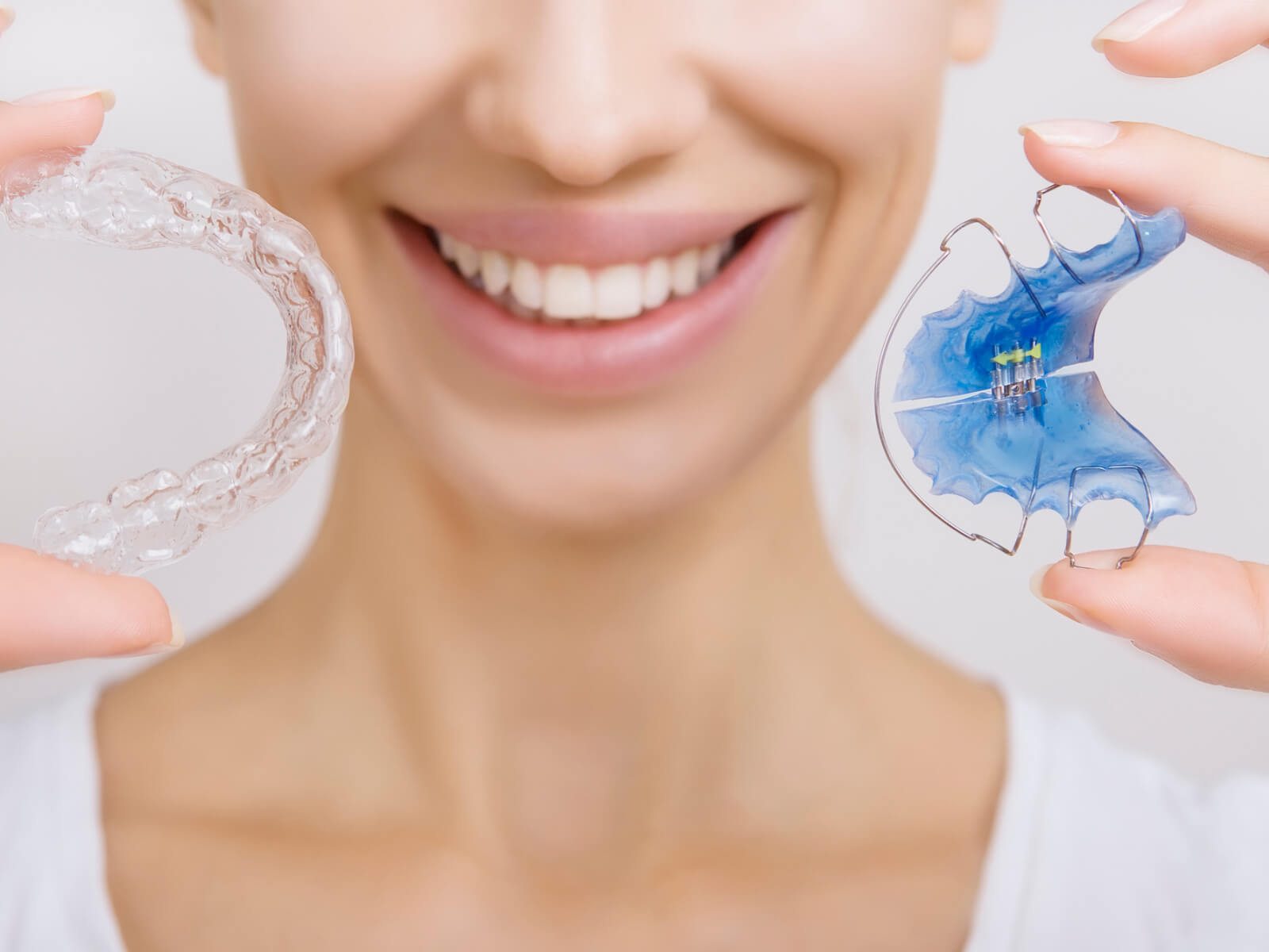 Bonded Retainers: Pros, Cons, And What You Need To Know