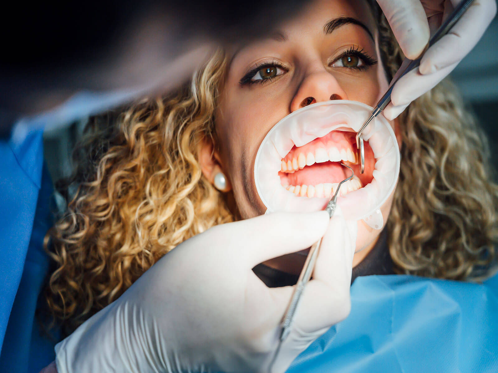 How Often Should You Go to the Dentist?