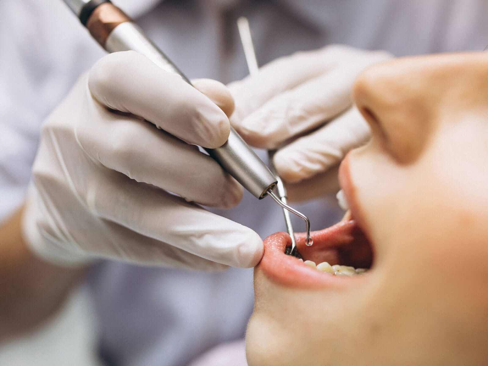 Root Canal vs Tooth Extraction: Which Is Better?