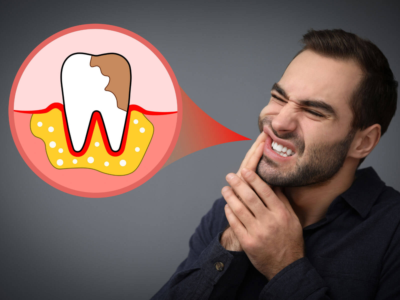 Signs of Infection After a Root Canal: When to Call Your Dentist
